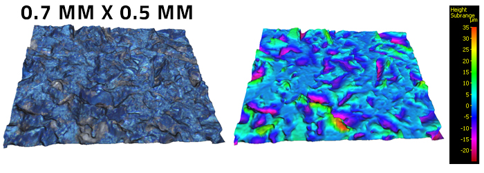 3D Medical Surface Finish and Volume Measurement of Spinal Screws